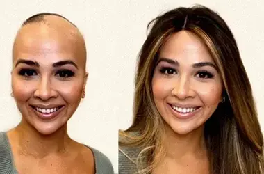 Chemotherapy Wigs