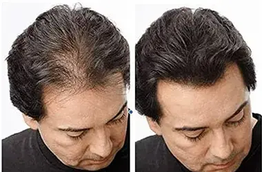 Hair Fibers