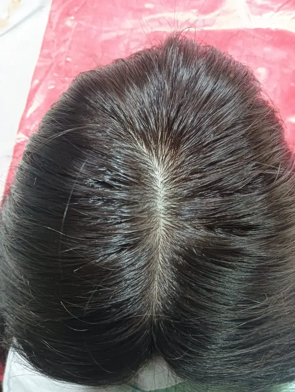 Vacuum Fit Medical Wig - Image 2